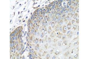 Immunohistochemistry of paraffin-embedded Human esophagus using TMOD3 Polyclonal Antibody at dilution of 1:100 (40x lens). (TMOD3 antibody)