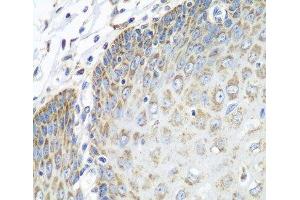 Immunohistochemistry of paraffin-embedded Human esophagus using TMOD3 Polyclonal Antibody at dilution of 1:100 (40x lens).