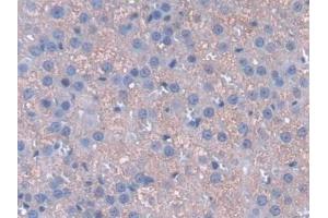 Detection of CYGB in Rat Adrenal gland Tissue using Polyclonal Antibody to Cytoglobin (CYGB) (CYGB antibody  (AA 1-190))