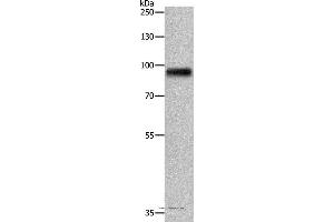 Western blot analysis of Human fetal brain tissue, using APLP1 Polyclonal Antibody at dilution of 1:650 (APLP1 antibody)