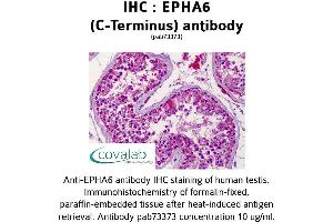 Image no. 2 for anti-EPH Receptor A6 (Epha6) antibody (ABIN1734079) (EPH Receptor A6 antibody)