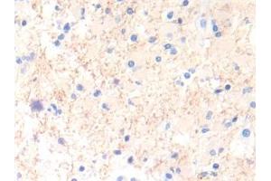 Immunohistochemistry (IHC) image for anti-Interleukin 13 (IL13) (AA 25-146) antibody (ABIN7430663)