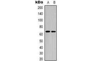 Western blot analysis of NF-kappaB p65 (AcK122) expression in HepG2 UV-treated (A), mouse brain (B) whole cell lysates. (NF-kB p65 antibody  (acLys122))