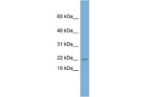 WB Suggested Anti-PTGES3 Antibody Titration: 0. (PTGES3 antibody  (Middle Region))