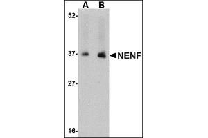 Western blot analysis of NENF in human kidney tissue lysate with this product at (A) 1 and (B) 2 μg/ml. (Neudesin antibody  (C-Term))