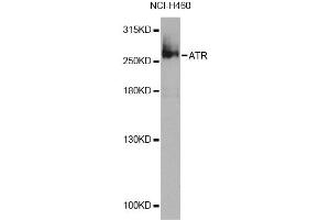 Western blot analysis of extracts of NCI-H460 cells, using ATR Antibody (ABIN4902988) at 1:1000 dilution. (ATR antibody)