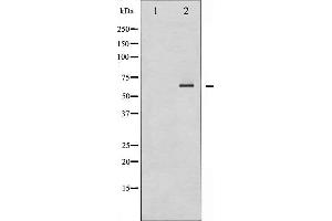 Western blot analysis of SHP-2 expression in A431 whole cell lysates,The lane on the left is treated with the antigen-specific peptide.