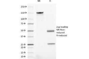 SDS-PAGE Analysis Purified CD43 Mouse Recombinant Monoclonal Antibody (rSPN/1094). (Recombinant CD43 antibody)