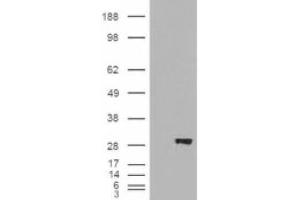 Image no. 1 for anti-3-hydroxybutyrate Dehydrogenase, Type 2 (BDH2) (AA 60-71), (Internal Region) antibody (ABIN374915) (BDH2 antibody  (Internal Region))