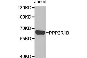 Western blot analysis of extracts of Jurkat cell line, using PPP2R1B antibody. (PPP2R1B antibody)
