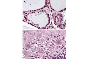 Immunohistochemical staining of human thyroid (A) and human brain, cerebellum (B) with PROKR2 polyclonal antibody . (Prokineticin Receptor 2 antibody  (N-Term))