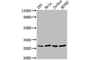 Western Blot Positive WB detected in: 293 whole cell lysate, Hela whole cell lysate, Jurkat whole cell lysate, HUVEC whole cell lysate All lanes: CACYBP antibody at 2. (CACYBP antibody  (AA 2-228))