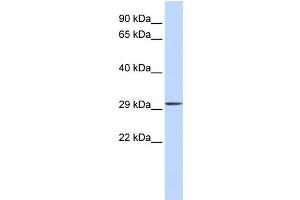 WB Suggested Anti-C1orf111 Antibody Titration:  0. (C1ORF111 antibody  (Middle Region))
