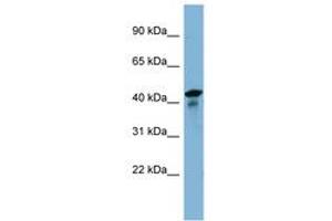 Image no. 1 for anti-UEV and Lactate/malate Dehyrogenase Domains (UEVLD) (AA 35-84) antibody (ABIN6742157) (UEVLD antibody  (AA 35-84))