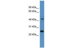 Image no. 1 for anti-Transcription Factor Dp-1 (TFDP1) (AA 21-70) antibody (ABIN6746158) (DP1 antibody  (AA 21-70))