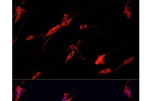 Immunofluorescence analysis of PC-12 cells using ENO2 Polyclonal Antibody at dilution of 1:100. (ENO2/NSE antibody)