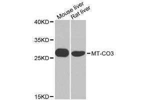 Western blot analysis of extracts of various cell lines, using MT-CO3 antibody. (COX3 antibody  (AA 1-100))