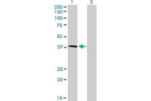 Western Blotting (WB) image for anti-Hemochromatosis (HFE) (AA 115-205) antibody (ABIN561252)