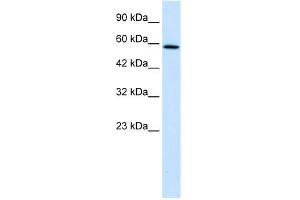 WB Suggested Anti-TBC1D10B Antibody Titration:  1. (TBC1D10B antibody  (C-Term))