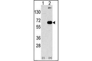 Western blot analysis of SQSTM1 (arrow) using SQSTM1 Antibody . (SQSTM1 antibody  (C-Term))