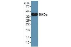 Detection of Recombinant DEFa4, Human using Polyclonal Antibody to Defensin Alpha 4, Corticostatin (DEFa4) (DEFA4 antibody  (AA 23-97))