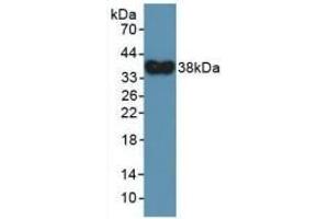 Detection of Recombinant DEFa4, Human using Polyclonal Antibody to Defensin Alpha 4, Corticostatin (DEFa4)