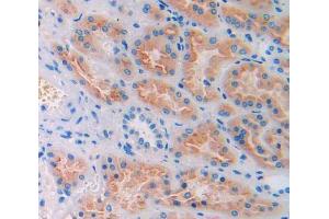 IHC-P analysis of kidney tissue, with DAB staining. (CUBN antibody  (AA 3511-3623))