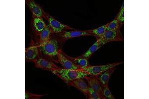 Immunofluorescence analysis of 3T3-L1 cells using EEF2 mouse mAb (green). (EEF2 antibody)