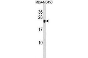 CRIP2 Antibody (C-term) western blot analysis in MDA-MB453 cell line lysates (35µg/lane). (CRIP2 antibody  (C-Term))