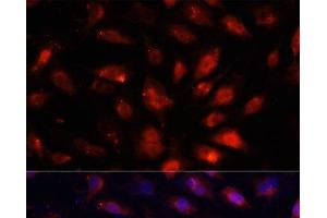 Immunofluorescence analysis of NIH/3T3 cells using ENO3 Polyclonal Antibody at dilution of 1:100. (ENO3 antibody)