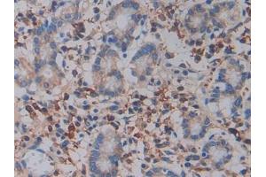 Detection of ITGb3 in Human Stomach Tissue using Polyclonal Antibody to Integrin Beta 3 (ITGb3) (Integrin beta 3 antibody  (AA 135-377))
