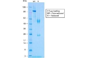 SDS-PAGE Analysis Purified TNF alpha Rabbit Recombinant Monoclonal Antibody (TNF/1500R). (Recombinant TNF alpha antibody)