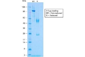 SDS-PAGE Analysis Purified TNF alpha Rabbit Recombinant Monoclonal Antibody (TNF/1500R).
