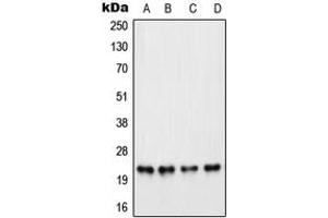 Western blot analysis of PARP1 expression in HeLa PMA-treated (A), Raw264. (PARP1 antibody  (Center))