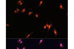 Immunofluorescence analysis of L929 cells using YAP1 Polyclonal Antibody at dilution of 1:100. (YAP1 antibody)