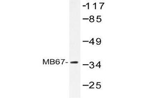 Western blot (WB) analysis of MB67 antibody in extracts from Jurkat cells.