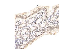 Immunohistochemistry of paraffin embedded rat colon using USP13 (ABIN7076106) at dilution of 1:700 (400x lens) (USP13 antibody)