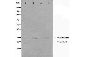 Western blot analysis on K562,Jurkat and 293 cell lysate using RPL10 Antibody. (RPL10 antibody  (N-Term))