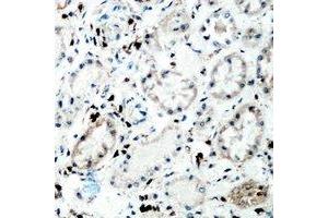 Immunohistochemical analysis of Tenascin C staining in human kidney formalin fixed paraffin embedded tissue section. (TNC antibody  (C-Term))
