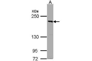 WB Image Sample (30μg whole cell lysate) A:Raji , 5% SDS PAGE antibody diluted at 1:1000