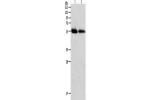 Western Blotting (WB) image for anti-Matrix Metallopeptidase 11 (Stromelysin 3) (MMP11) antibody (ABIN2426224) (MMP11 antibody)
