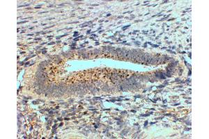ABIN2559899 (2µg/ml) staining of paraffin embedded Human Uterus.