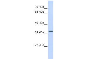 WB Suggested Anti-APTX Antibody Titration:  0. (Aprataxin antibody  (Middle Region))