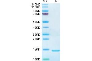 DDT Protein (AA 2-118) (His tag)
