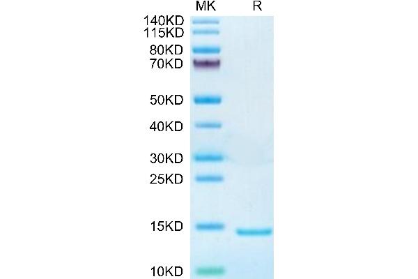 DDT Protein (AA 2-118) (His tag)