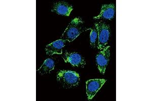 Confocal immunofluorescent analysis of BTC Antibody (N-term) (ABIN655615 and ABIN2845096) with MDA-M cell followed by Alexa Fluor 488-conjugated goat anti-rabbit lgG (green). (Betacellulin antibody  (N-Term))