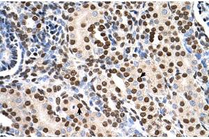 Human kidney (RSU1 antibody  (C-Term))