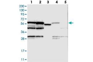 Western blot analysis of Lane 1: RT-4, Lane 2: U-251 MG, Lane 3: Human Plasma, Lane 4: Liver, Lane 5: Tonsil with MPP6 polyclonal antibody .