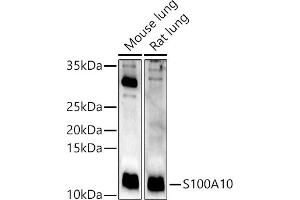 Western blot analysis of extracts of various cell lines, using S100 antibody (ABIN3015803, ABIN3015804, ABIN3015805, ABIN1682607 and ABIN6219148) at 1:400 dilution. (S100A10 antibody  (AA 1-97))