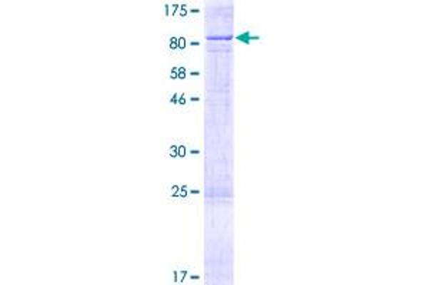 CYP11B1 Protein (AA 1-574) (GST tag)